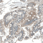 Immunohistochemical staining of human Duodenum shows weak cytoplasmic positivity in glandular cells.