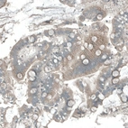 Immunohistochemical staining of human Duodenum shows weak cytoplasmic positivity in glandular cells.