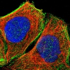 Immunofluorescent staining of human cell line A-431 shows localization to cytosol & actin filaments.