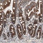 Anti-TOMM22 Antibody