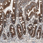Immunohistochemical staining of human duodenum shows strong granular cytoplasmic positivity in glandular cells.