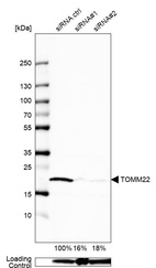 Anti-TOMM22 Antibody