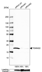 Western blot analysis in U2OS cells transfected with control siRNA, target specific siRNA probe #1 and #2, using Anti-TOMM22 antibody. Remaining relative intensity is presented. Loading control: Anti-GAPDH.