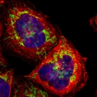 Immunofluorescent staining of human cell line A-431 shows localization to mitochondria.