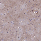Immunohistochemical staining of human cerebral cortex shows moderate cytoplasmic positivity in neuropil.