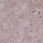 Anti-MLC1 Antibody