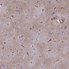 Immunohistochemical staining of human cerebral cortex shows moderate cytoplasmic positivity in neuropil.