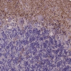 Immunohistochemical staining of human cerebellum shows moderate cytoplasmic positivity in neuropil of the molecular layer.