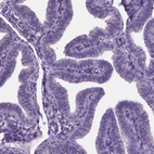 Immunohistochemical staining of human fallopian tube shows no positivity in glandular cells as expected.