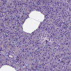 Anti-MLC1 Antibody