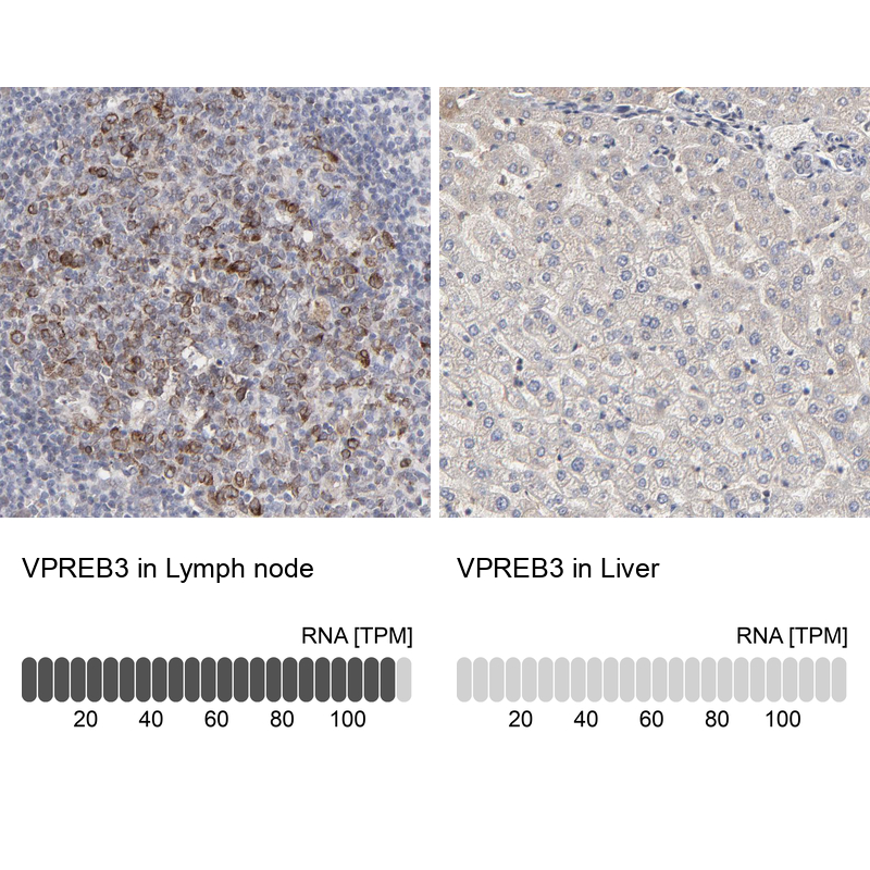 Anti-VPREB3 Antibody