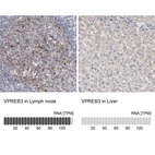 Anti-VPREB3 Antibody