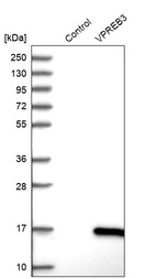 Western blot analysis in control (vector only transfected HEK293T lysate) and VPREB3 over-expression lysate (Co-expressed with a C-terminal myc-DDK tag (~3.1 kDa) in mammalian HEK293T cells, LY415623).