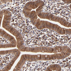 Anti-BAIAP2L2 Antibody