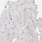 Anti-BAIAP2L2 Antibody