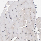 Immunohistochemical staining of human skeletal muscle shows no positivity in myocytes as expected.