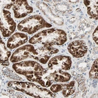 Immunohistochemical staining of human kidney shows strong cytoplasm granular positivity in cells in proximal tubules.