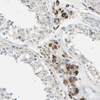 Anti-TST Antibody