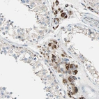 Immunohistochemical staining of human testis shows strong cytoplasm granular positivity in Leydig cells.