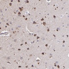 Anti-MAGEE1 Antibody