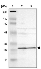 Lane 1: Marker [kDa] 230, 110, 82, 49, 32, 26, 18_br/_Lane 2: Human cell line RT-4_br/_Lane 3: Human cell line U-251MG sp