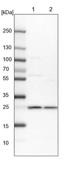 Lane 1: NIH-3T3 cell lysate (Mouse embryonic fibroblast cells)_br/_Lane 2: NBT-II cell lysate (Rat Wistar bladder tumour cells)