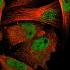 Immunofluorescent staining of human cell line U-251 MG shows localization to nucleoplasm.