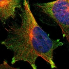 Immunofluorescent staining of human cell line U-251 MG shows localization to plasma membrane & cytosol.