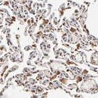 Immunohistochemical staining of human lung shows strong cytoplasmic positivity in macrophages.