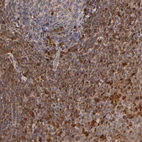 Immunohistochemical staining of human tonsil shows strong cytoplasmic positivity in non-germinal center cells.