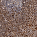 Immunohistochemical staining of human tonsil shows strong cytoplasmic positivity in non-germinal center cells.