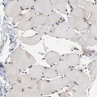 Immunohistochemical staining of human skeletal muscle shows no positivity in myocytes as expected.