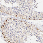 Anti-ASB9 Antibody