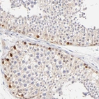 Immunohistochemical staining of human testis shows moderate membranous positivity in cells in seminiferous ducts.
