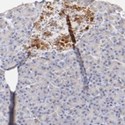Immunohistochemical staining of human pancreas shows strong granular cytoplasmic positivity in the islets of Langerhans.
