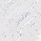 Immunohistochemical staining of human skeletal muscle shows no positivity in myocytes as expected.