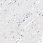 Immunohistochemical staining of human skeletal muscle shows no positivity in myocytes as expected.