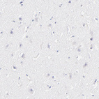 Immunohistochemical staining of human cerebral cortex shows no positivity in neurons as expected.