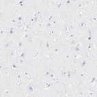 Anti-ASB9 Antibody