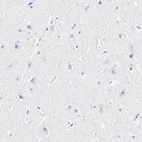 Immunohistochemical staining of human cerebral cortex shows no positivity in neurons as expected.