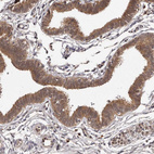 Anti-MDP1 Antibody