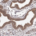 Immunohistochemical staining of human fallopian tube shows moderate cytoplasmic positivity in glandular cells.