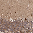 Immunohistochemical staining of human cerebellum shows strong cytoplasmic positivity in Purkinje cells.
