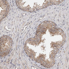 Anti-MDP1 Antibody