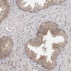 Immunohistochemical staining of human prostate shows moderate cytoplasmic positivity in glandular cells.