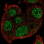 Immunofluorescent staining of human cell line PC-3 shows localization to nucleoplasm.