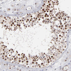 Anti-RGS6 Antibody