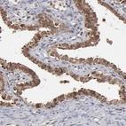 Immunohistochemical staining of human Fallopian tube shows moderate cytoplasmic and nuclear positivity in glandular cells.