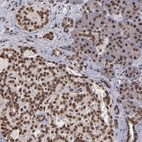 Anti-CSDC2 Antibody