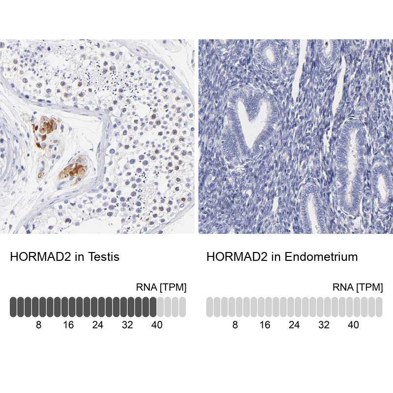 Anti-HORMAD2 Antibody